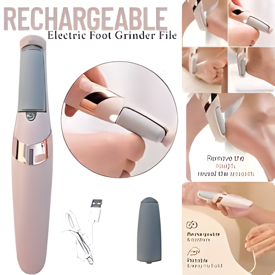 Electric Foot Callus Remover Tool – Electronic File for Dead Skin & Hard Tissue